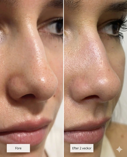 CLEAN™ Näsplåster