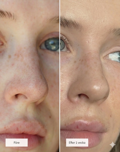 CLEAN™ Näsplåster